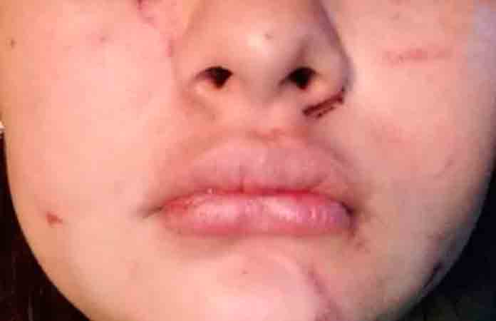 Capacitarán a funcionarios sobre violencia vicaria