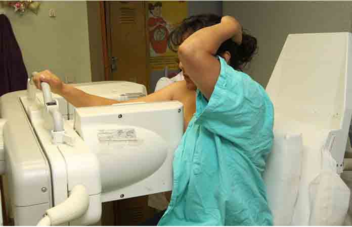 La ZM con 14 casos de cáncer de mama